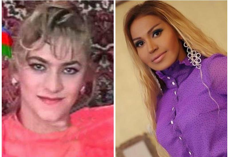 Dodaqlarını böyüdən məşhurlar