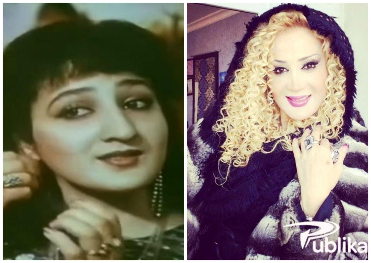 Dodaqlarını böyüdən məşhurlar