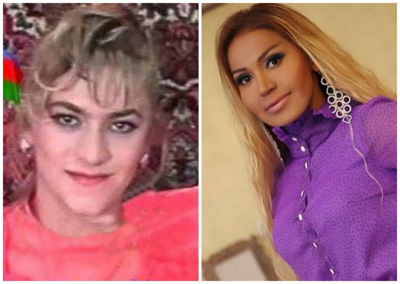 Dodaqlarını böyüdən məşhurlar