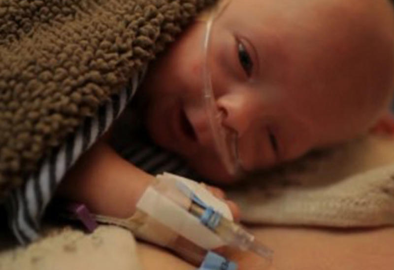История борьбы этого малыша за жизнь поражает