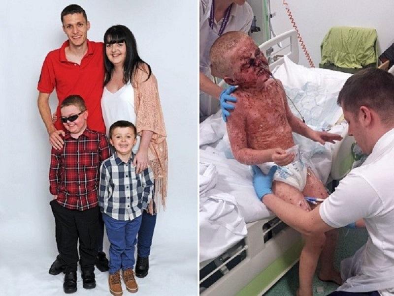 Аллергия чуть не сожгла ребенка изнутри