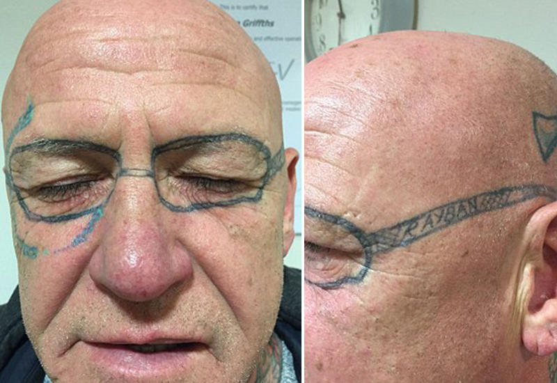 Проснувшись утром после вечеринки, мужчина увидел на лице это тату