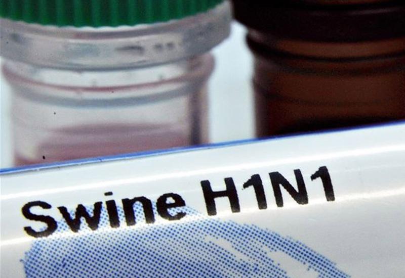 "Donuz qripi": Türkiyədə 57 nəfər həyatını itirdi