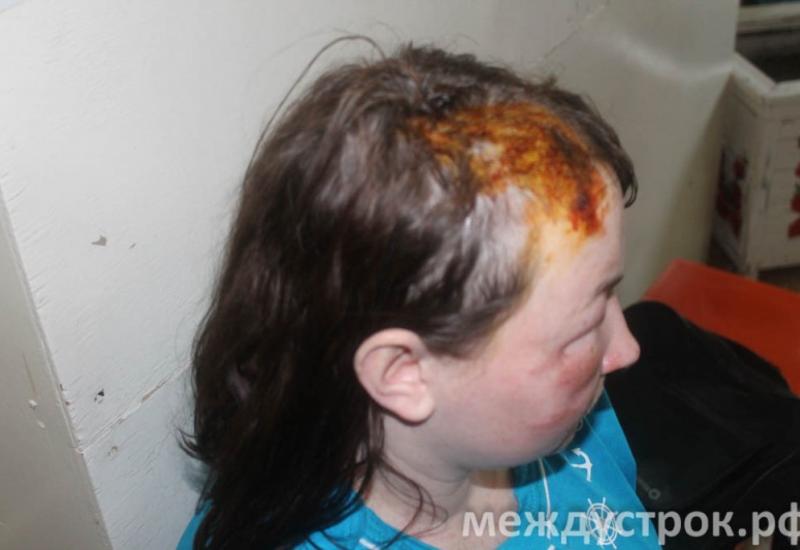 В Нижнем Тагиле мужчина плеснул женщине в лицо кислотой