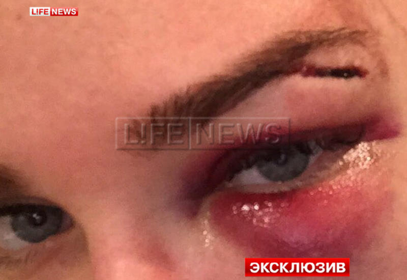 В Москве жестоко избили модель