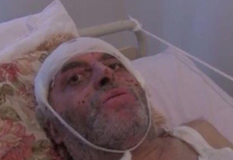 "Günəşli"də yanan neftçidən yeni xəbər