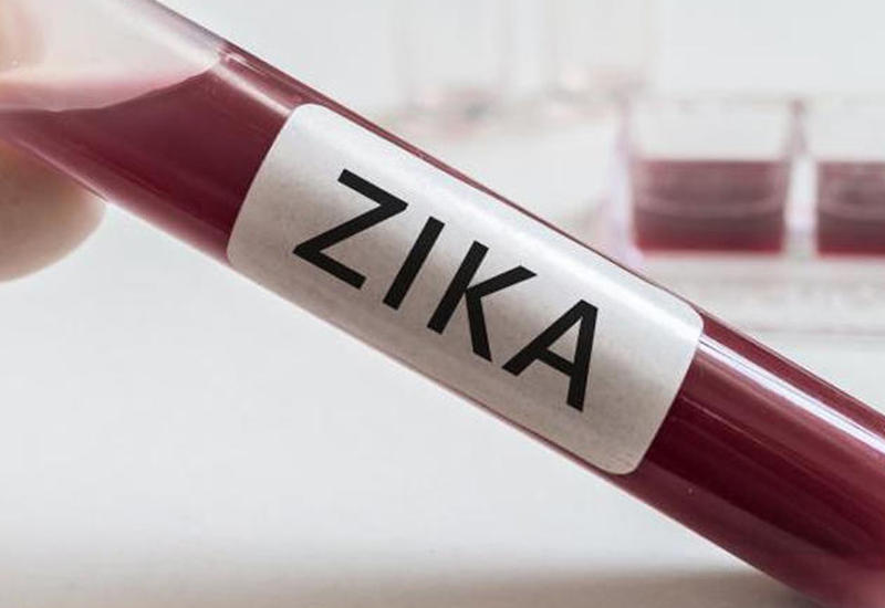 Təhlükə Rusiyada - Daha bir "Zika" virusuna yoluxma faktı