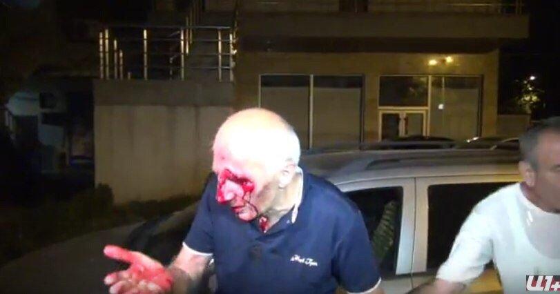 Побоище на улицах Еревана