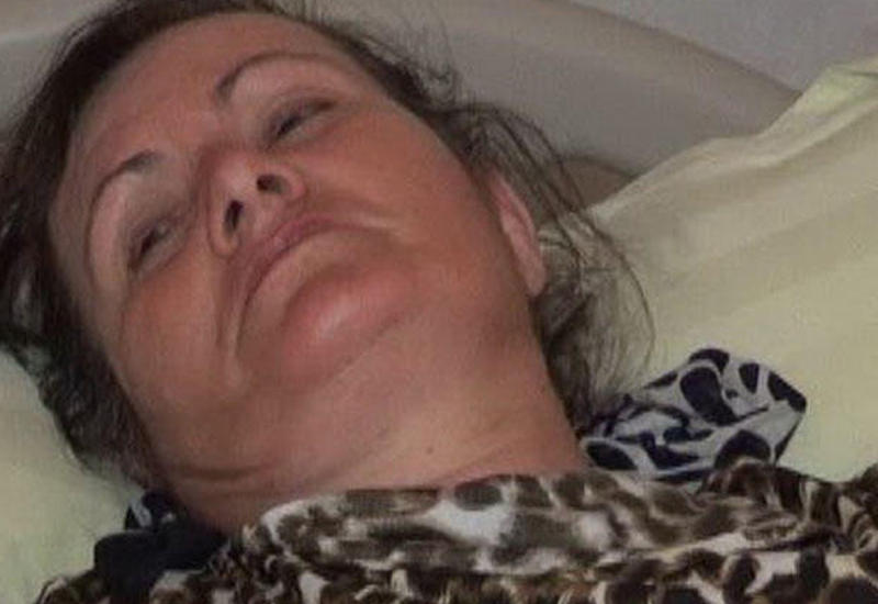 Cəlilabadda 45 yaşlı qadını əqrəb sancıb