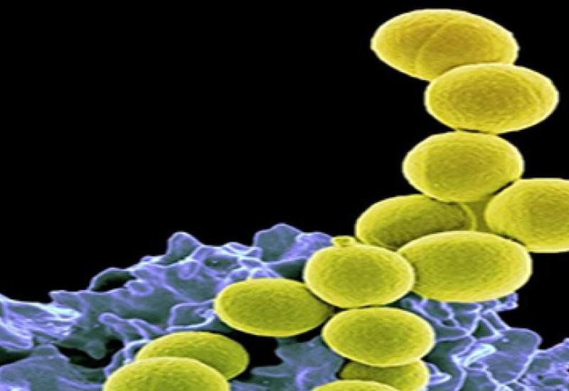 Alimlər yeni antibiotik aşkarlayıblar