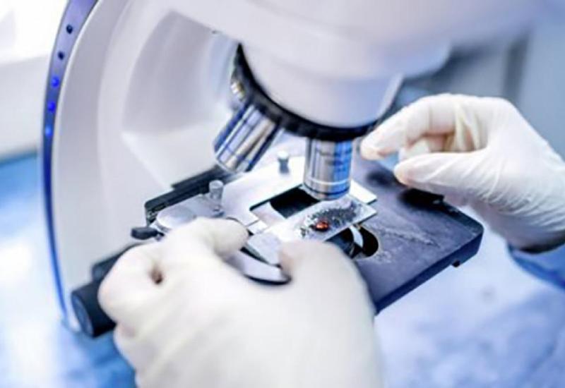 Xərçəngin diaqnostikasının unikal metodu kəşf edildi