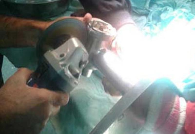 Azyaşlı uşağın əli ətçəkən maşında qaldı