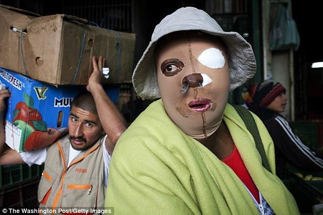 DƏHŞƏT: Bu ölkədə qadınların üzü yandırılır