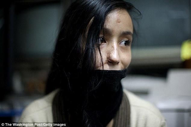 DƏHŞƏT: Bu ölkədə qadınların üzü yandırılır