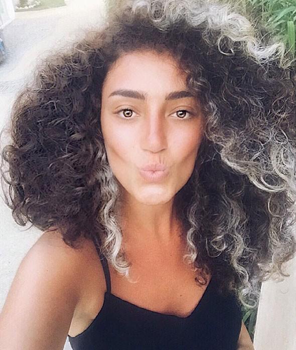 Tatlısəsin qızı plastik əməliyyat sonra...