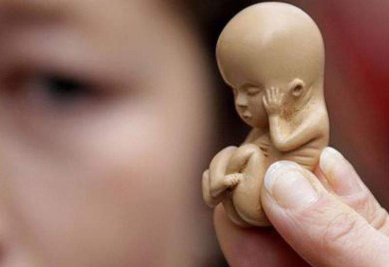 Qanunsuz aborta görə cəzalar sərtləşdirilir