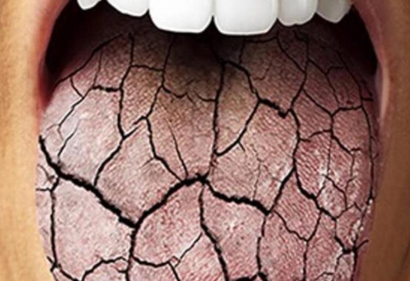 Bədən susuz qalarsa, nə baş verər?