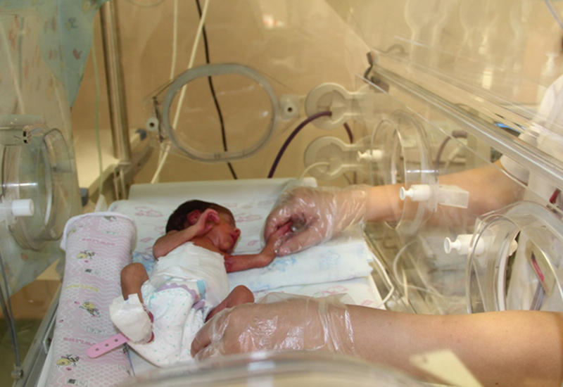 Mərkəzi Klinikanın yenidoğulmuşlar şöbəsində az çəkili körpəyə uğurlu cərrahi əməliyyat həyata keçirilib