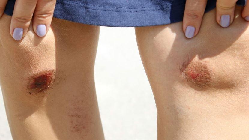 Qəzet redaktorunu yerdə sürüyüb çantasını apardılar