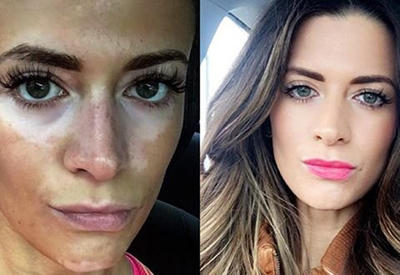 Бывшая модель показала, что прятала 10 лет под плотным слоем косметики... <span class="color_red">- ФОТО</span>