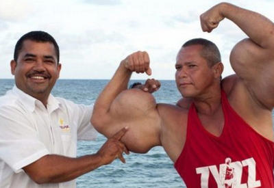 21 человек, который перестарался с применением химических препаратов <span class="color_red">- ФОТО</span>