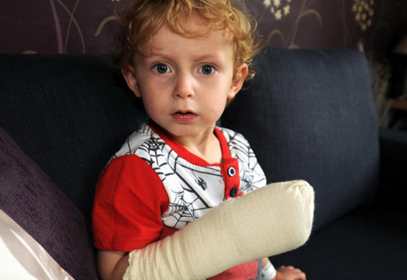 В Британии зарядка от ноутбука прожгла ребенку руку до кости