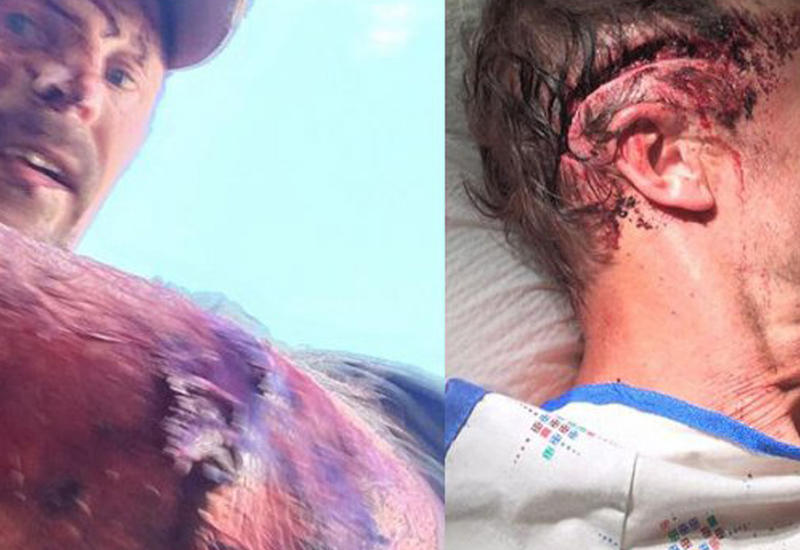 Американский охотник выжил после двух атак гризли