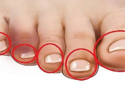 Прикоснитесь к пальцам ваших ног, и вы поймете, есть ли у вас проблемы с сердцем