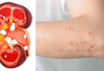 8 тревожных звонков от организма о больных почках