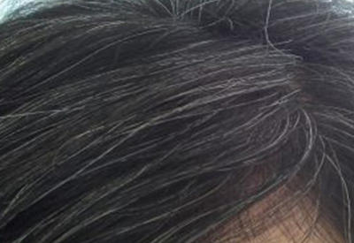 Что заставляет волосы седеть? Теперь этот процесс можно повернуть вспять!