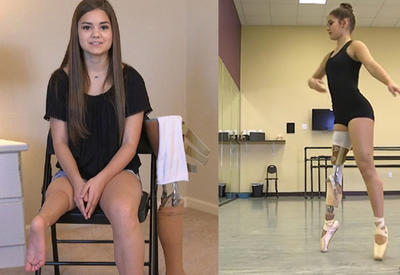 15-летняя девушка победила рак и стала балериной, несмотря на ампутацию ноги <span class="color_red">- 8 ФОТО - ВИДЕО</span>
