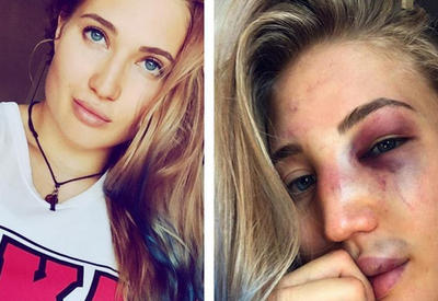 Как выглядят девушки после боев без правил <span class="color_red">- ФОТО</span>