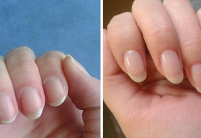 Как быстро отрастить ногти, которые никогда не сломаются: поможет простое средство из 4 компонентов! <span class="color_red">- ФОТО</span>
