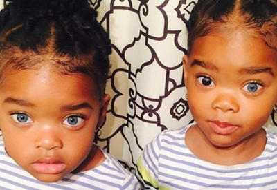 Эти девочки-близняшки покорили всех своими глазами <span class="color_red">- ФОТО</span>