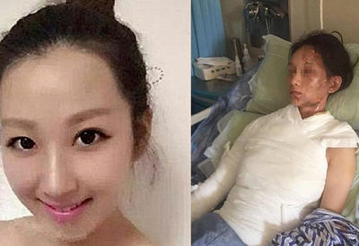 Женщина пожаловалась на обслуживание в ресторане, и ее облили кипящей водой <span class="color_red">- ФОТО - ВИДЕО</span>