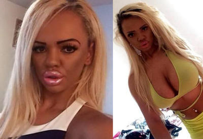 Австралийка переборщила с ботоксом и силиконом, и вот, что с ней стало! <span class="color_red">- ФОТО</span>