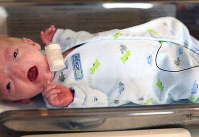 Этот малыш родился без носа! Но он такой милый… <span class="color_red">- ФОТО</span>