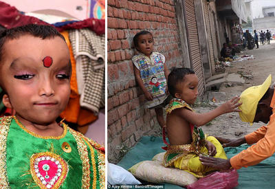 Жители индийской деревни поклоняются мальчику с деформированной головой как богу Ганеше <span class="color_red">- ФОТО</span>