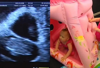 Эта женщина забеременела дважды за 10 дней <span class="color_red">- ФОТО</span>