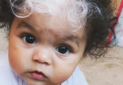 Эта девочка родилась с белой прядью на черных волосах, такой же, как и у ее мамы <span class="color_red">- ФОТО</span>