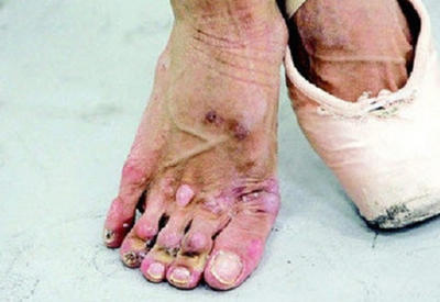 Цена совершенства: 11 шокирующих снимков из мира балета <span class="color_red">- ФОТО</span>