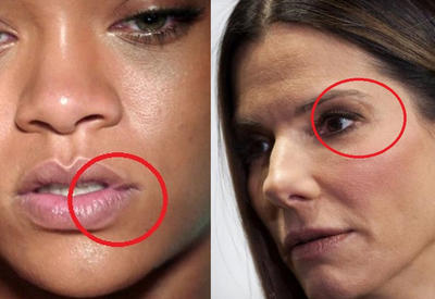 12 звезд, которые тщательно скрывают свои шрамы <span class="color_red">- ФОТО</span>