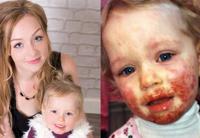 Эта девочка тяжело заболела из-за того, что делают 99% родителей! <span class="color_red">- ФОТО</span>