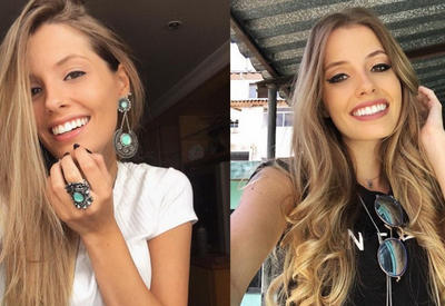 Эта девушка покорила Интернет своим &quot;недостатком&quot; <span class="color_red">- 14 ФОТО</span>