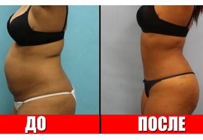 Самый мощный напиток для плоского живота всего за 7 дней