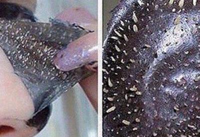 Как за одну ночь избавиться от всех прыщей? Натуральный и быстрый способ