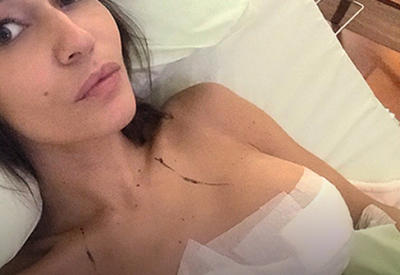 Сбавляем обороты: Алена Водонаева уменьшила грудь на два размера <span class="color_red">- 5 ФОТО</span>