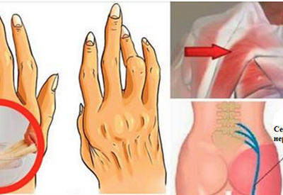 Простой и легкий трюк для облегчения боли при артрите, боли в спине и воспалении седалищного нерва