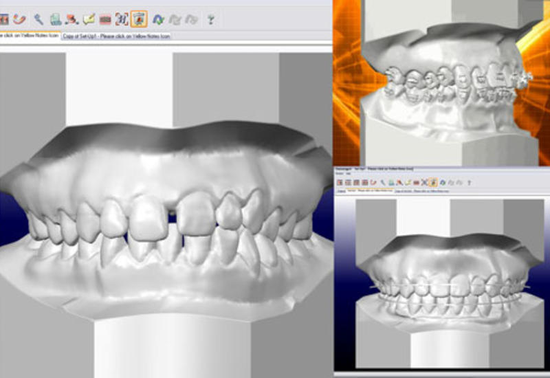 3D-моделирование зубов с помощью обычной фотографии