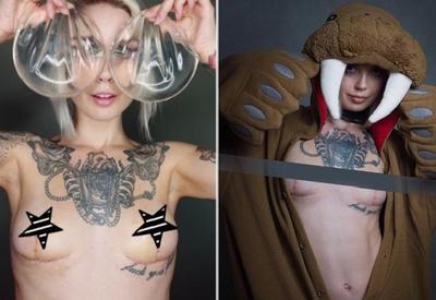 Как на самом деле выглядит грудь после удаления силиконовых имплантов